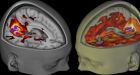 Behold, The First-Ever Brain Scans Of LSD's Mind-Altering Effects